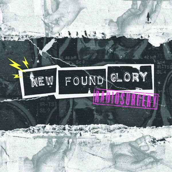 New Found Glory - Radiosurgery (Single) Cover Arts and Media | Records on Vinyl