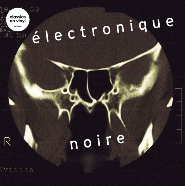  |   | Eivind Aarset - Electronique Noire (2 LPs) | Records on Vinyl